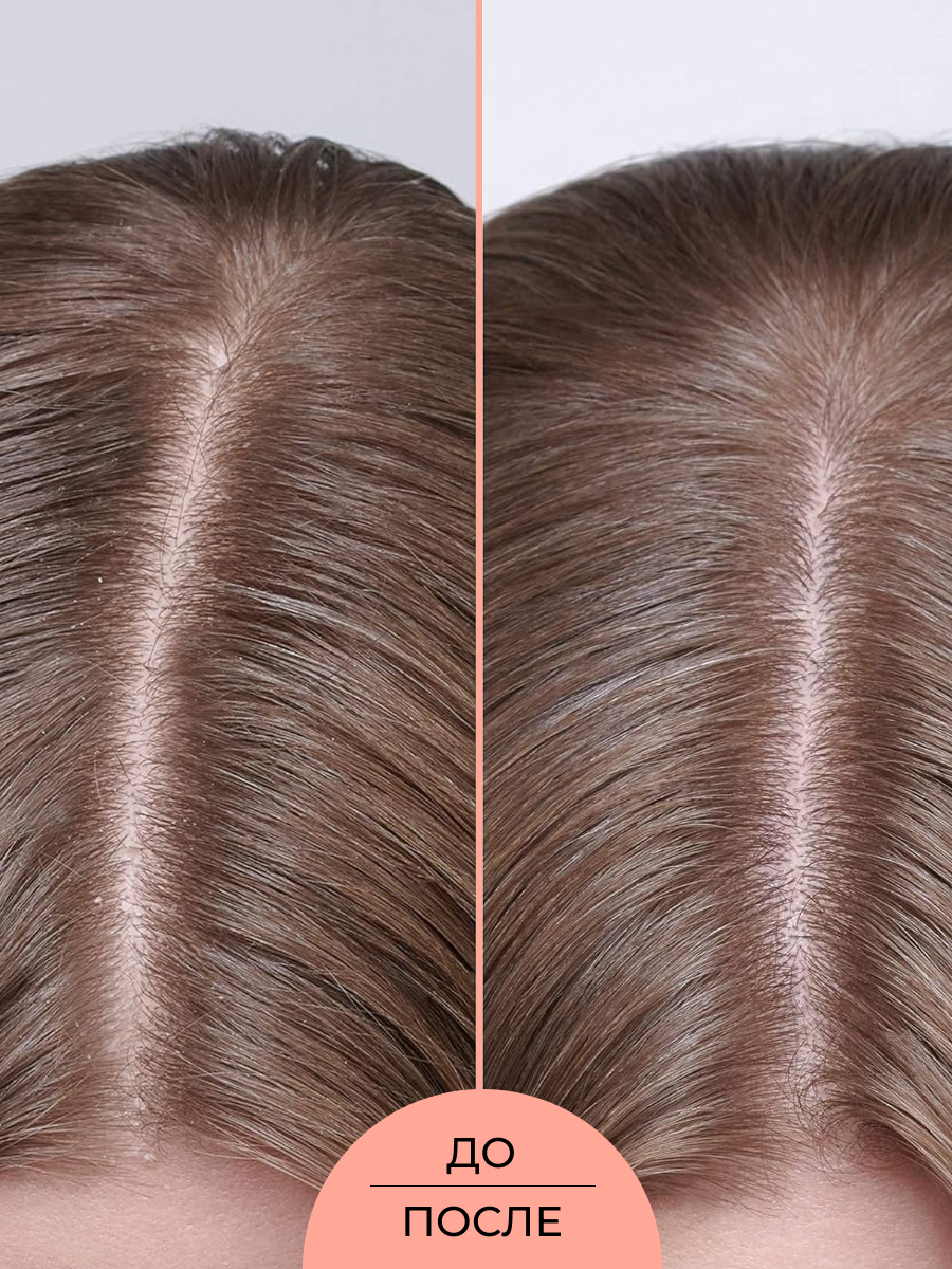 Оцениваем эффективность масок, бальзамов и витаминных комплексов от выпадения волос