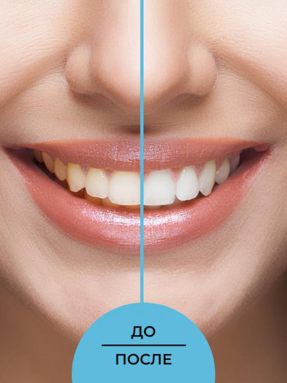 Зубной эко-порошок "Очищающий" ZBPR(1)-SIB